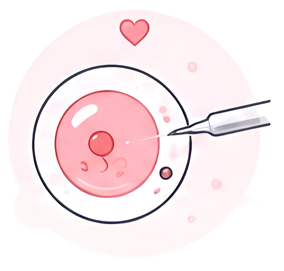 In Vitro Fertilization (IVF)